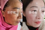嘿你想开个美容院搞祛斑却不知道该从哪儿下手是吧